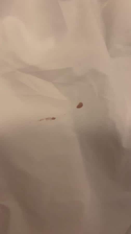 Blood stain on bed sheet 