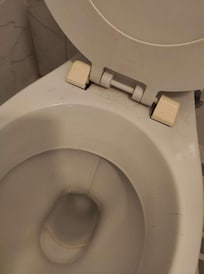 Hairy toilet bowl in loving detail