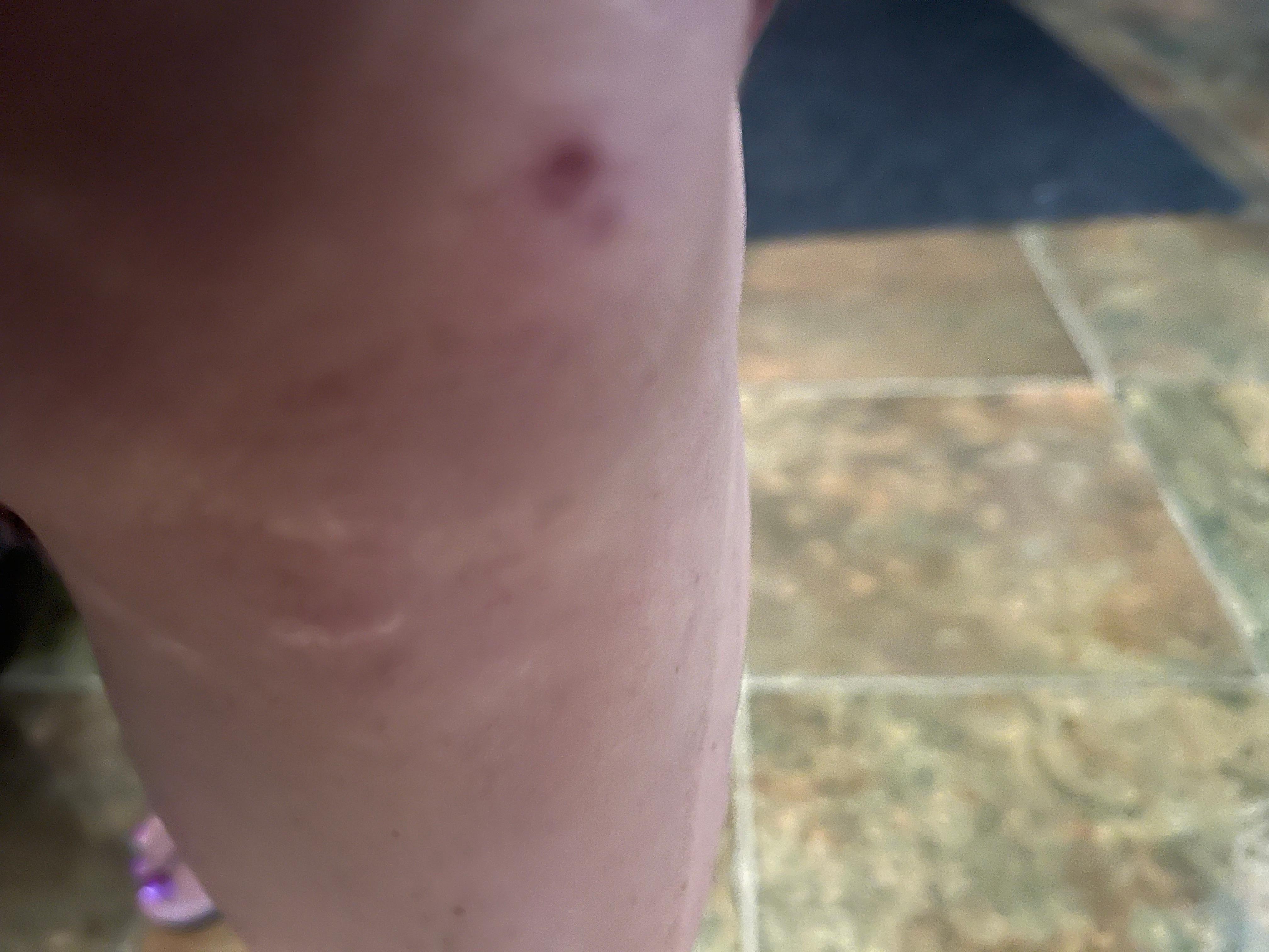 Knee scrape from step 