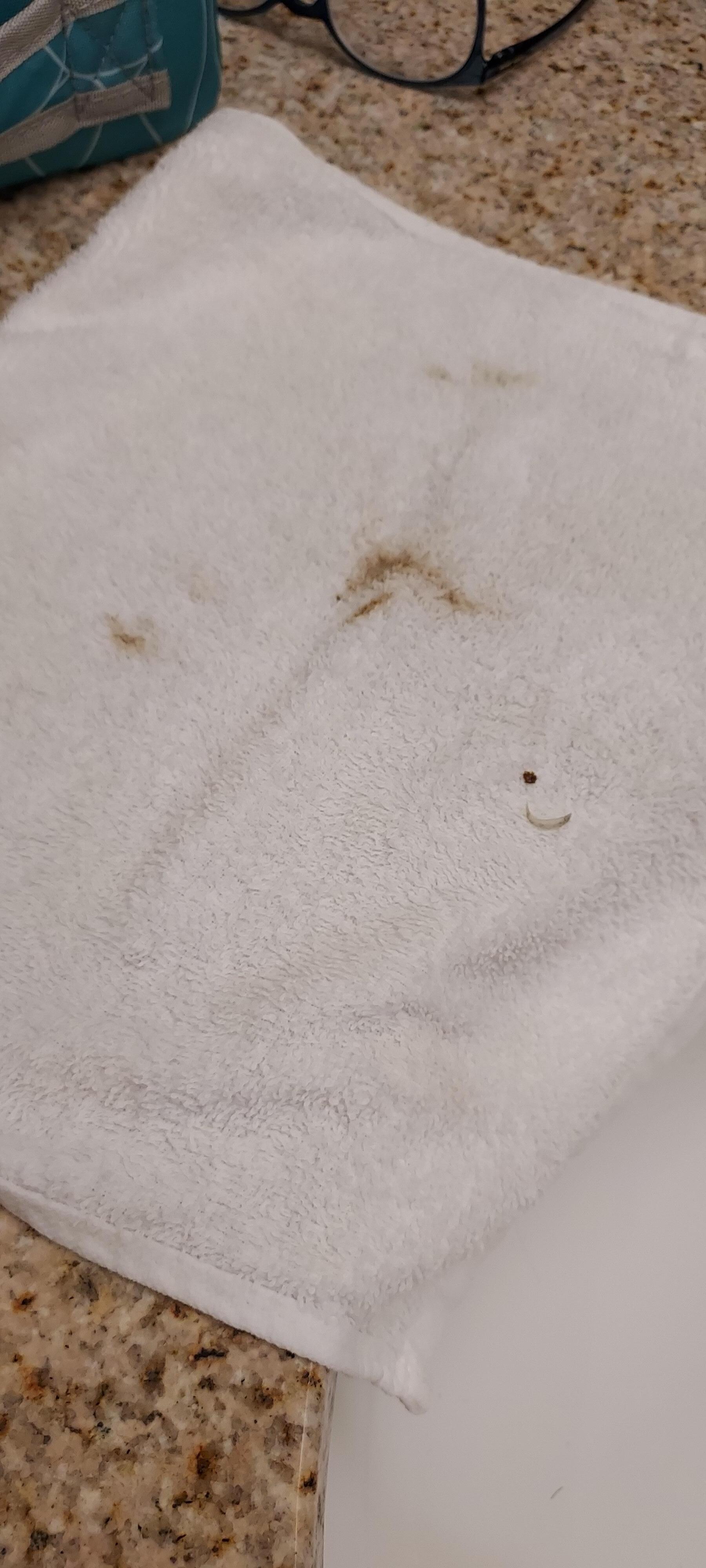 Orange dirt and a fingernail after I cleaned the sink myself