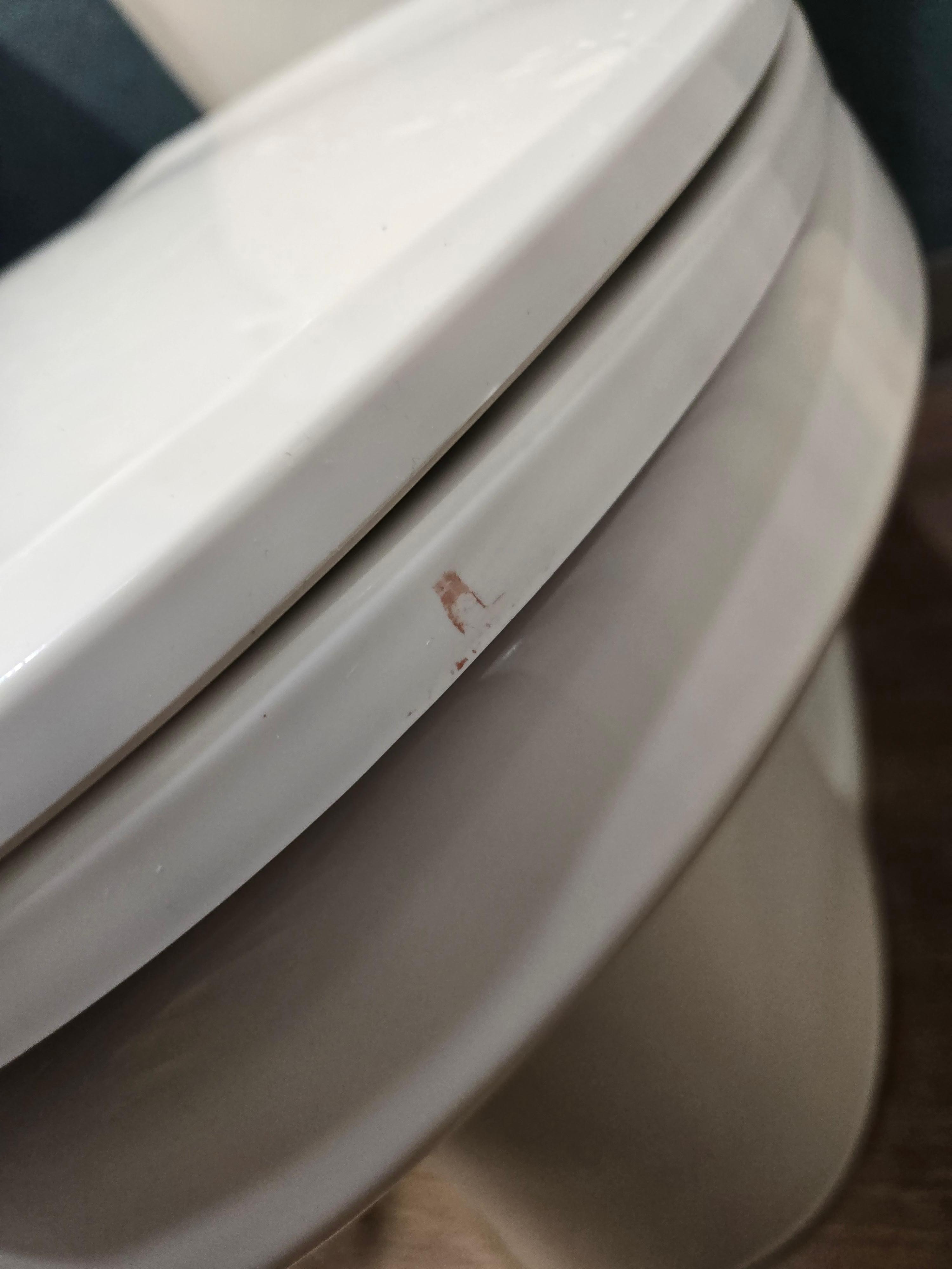 Uncleaned toilet seat