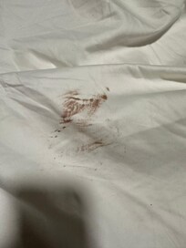 Stained sheets