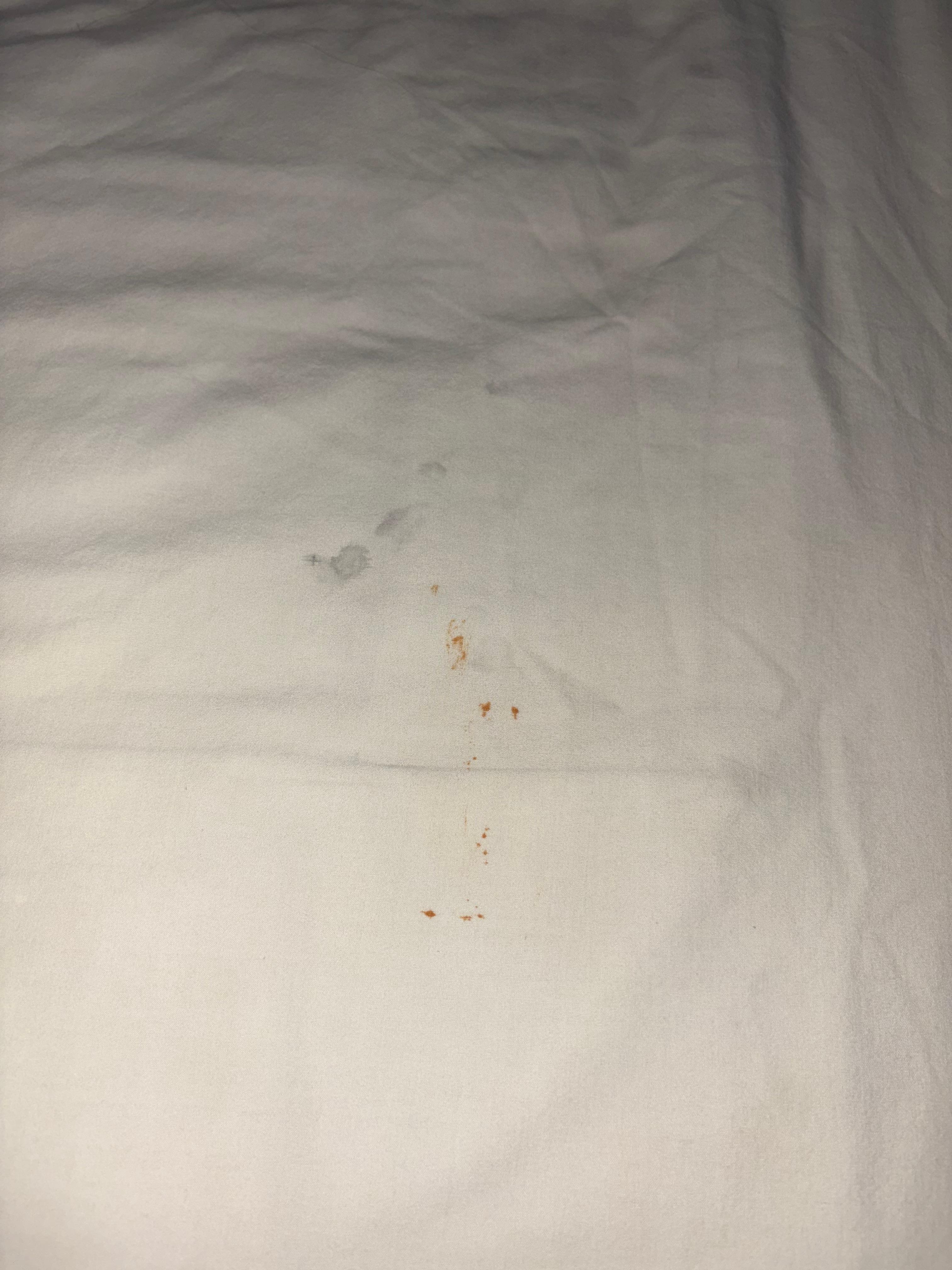 Stains on sheets
