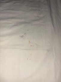 Stains on sheets