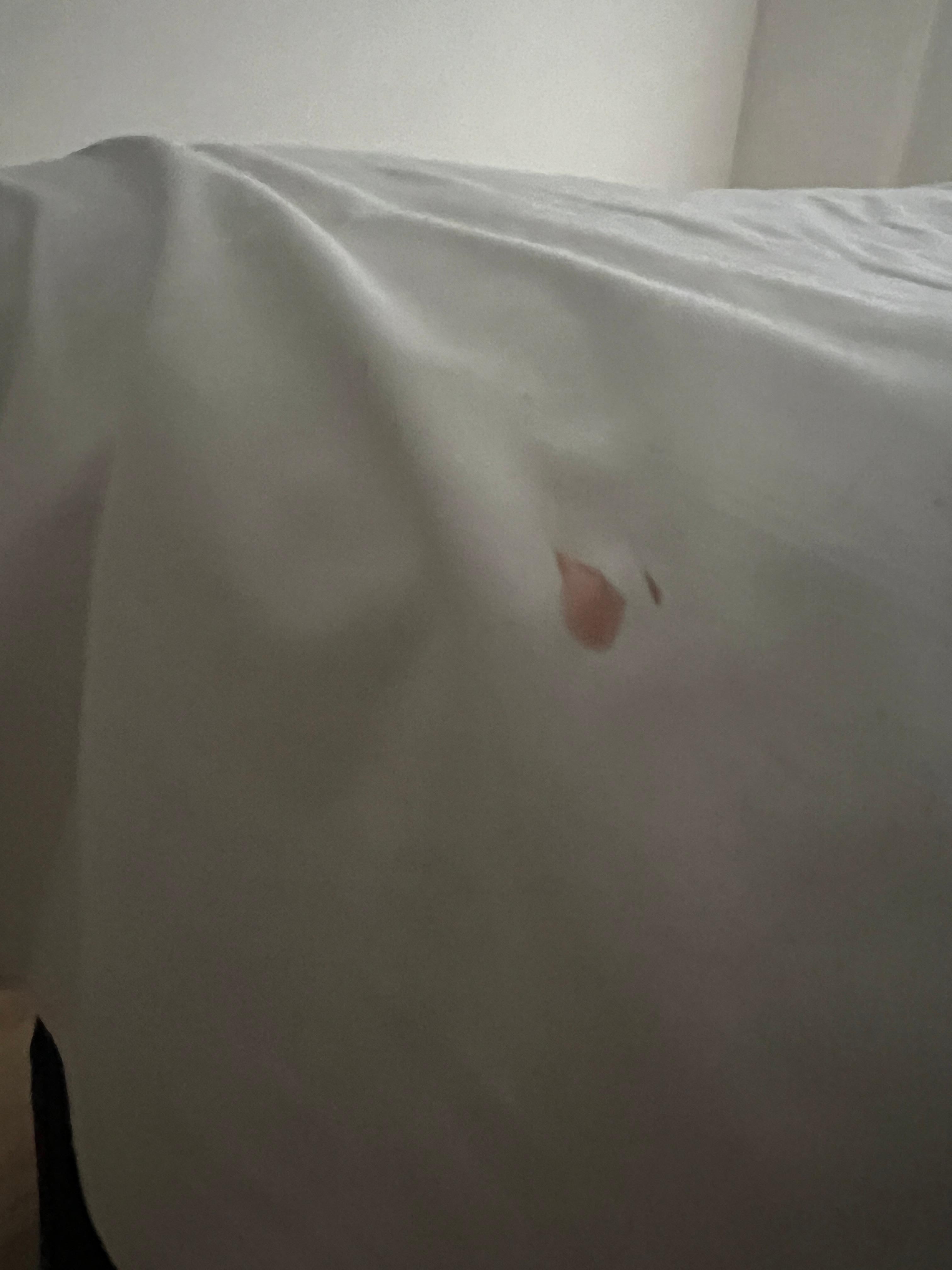 Stain on the bed