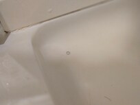 Pubic hair