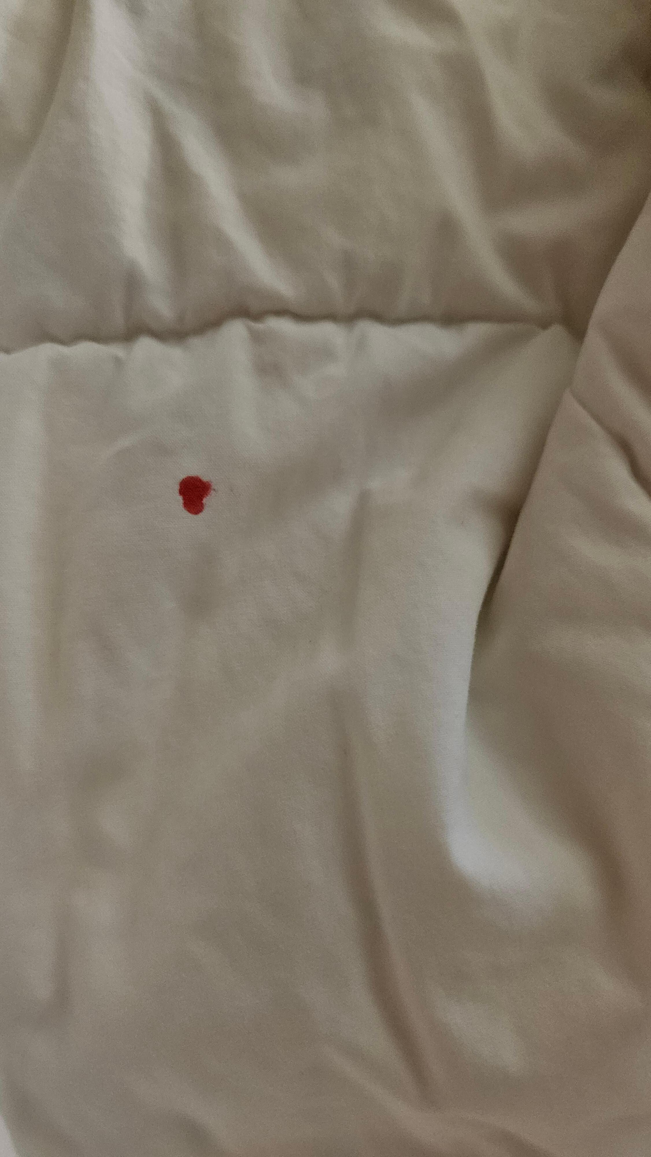 Blood on sheets.