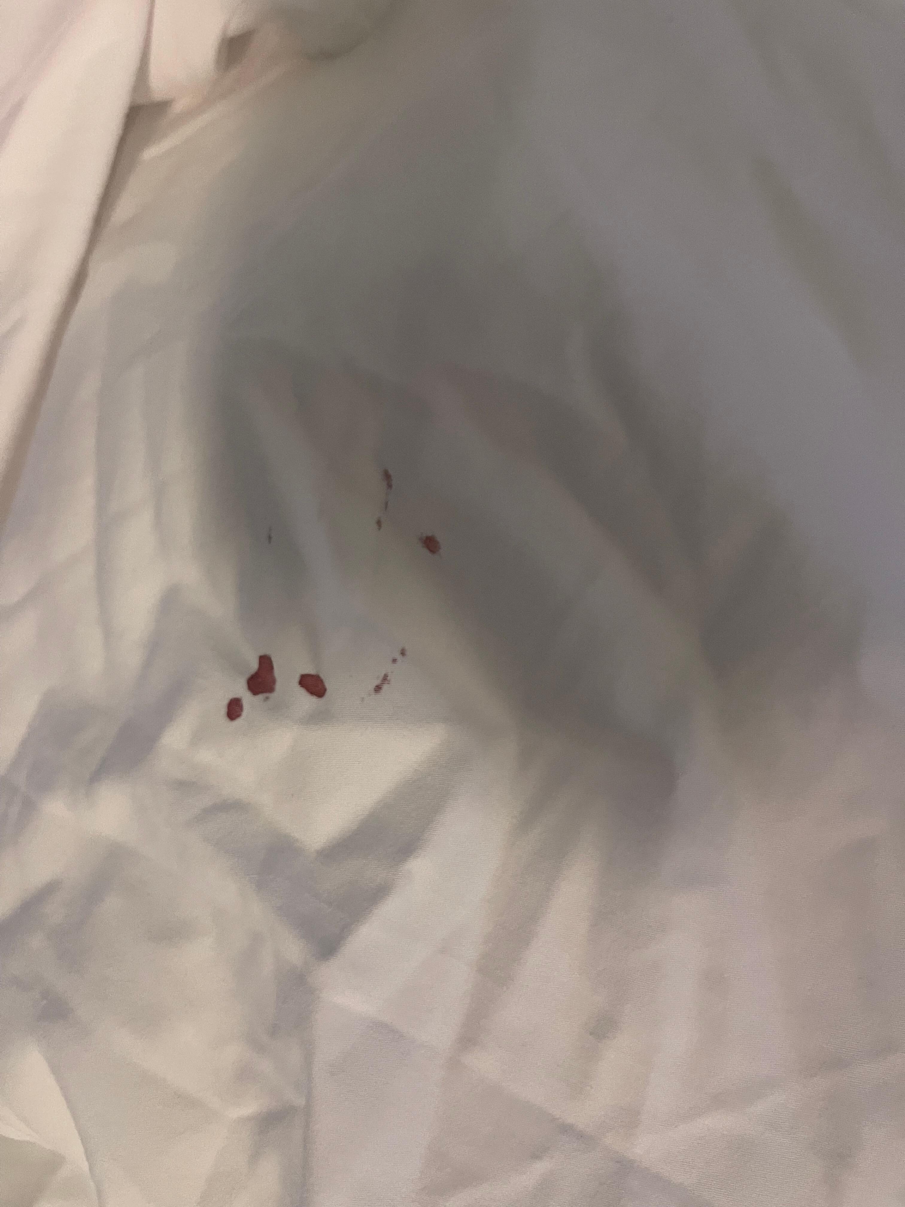 Blood on sheets 