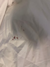 Blood on sheets