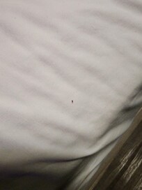 Bed bugs
