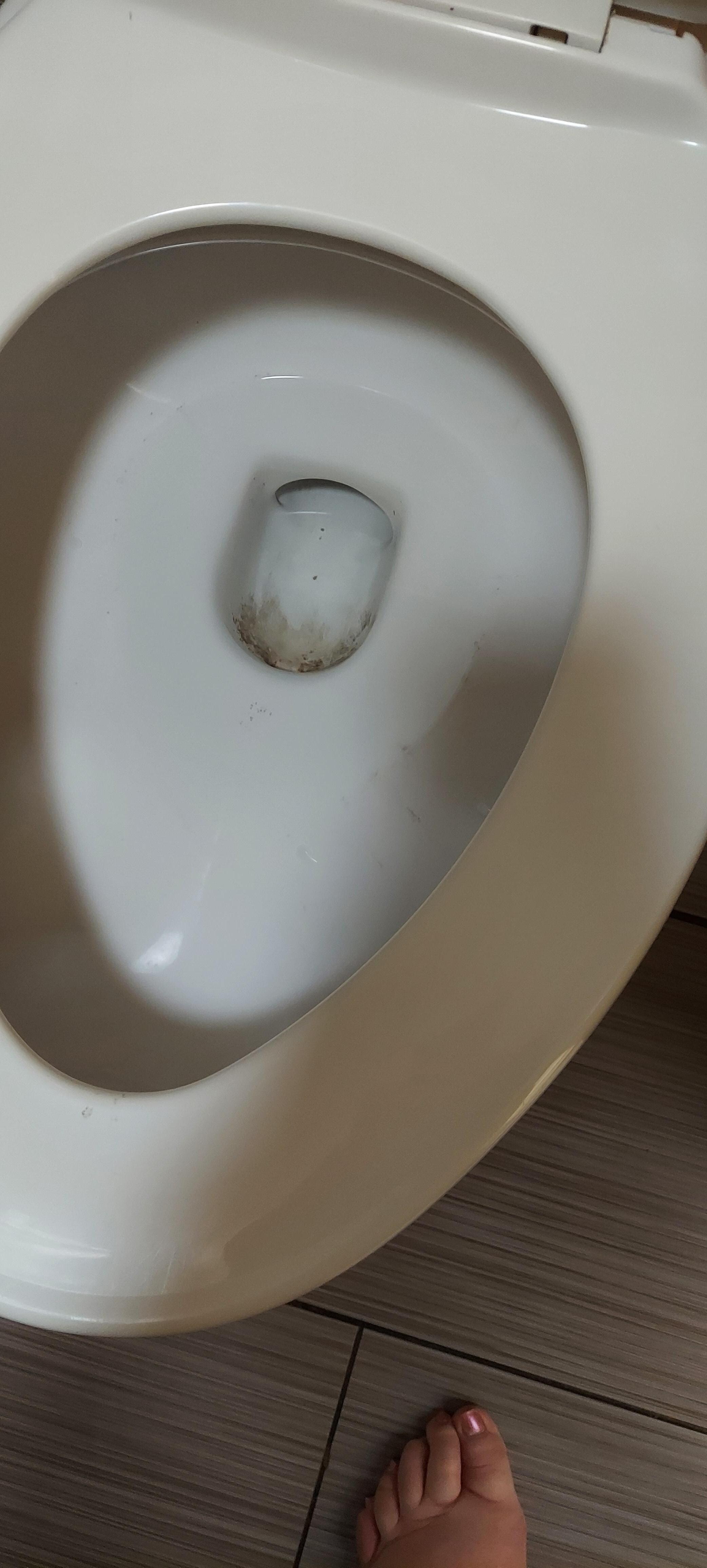Dirty toilet