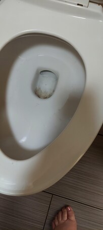 Dirty toilet