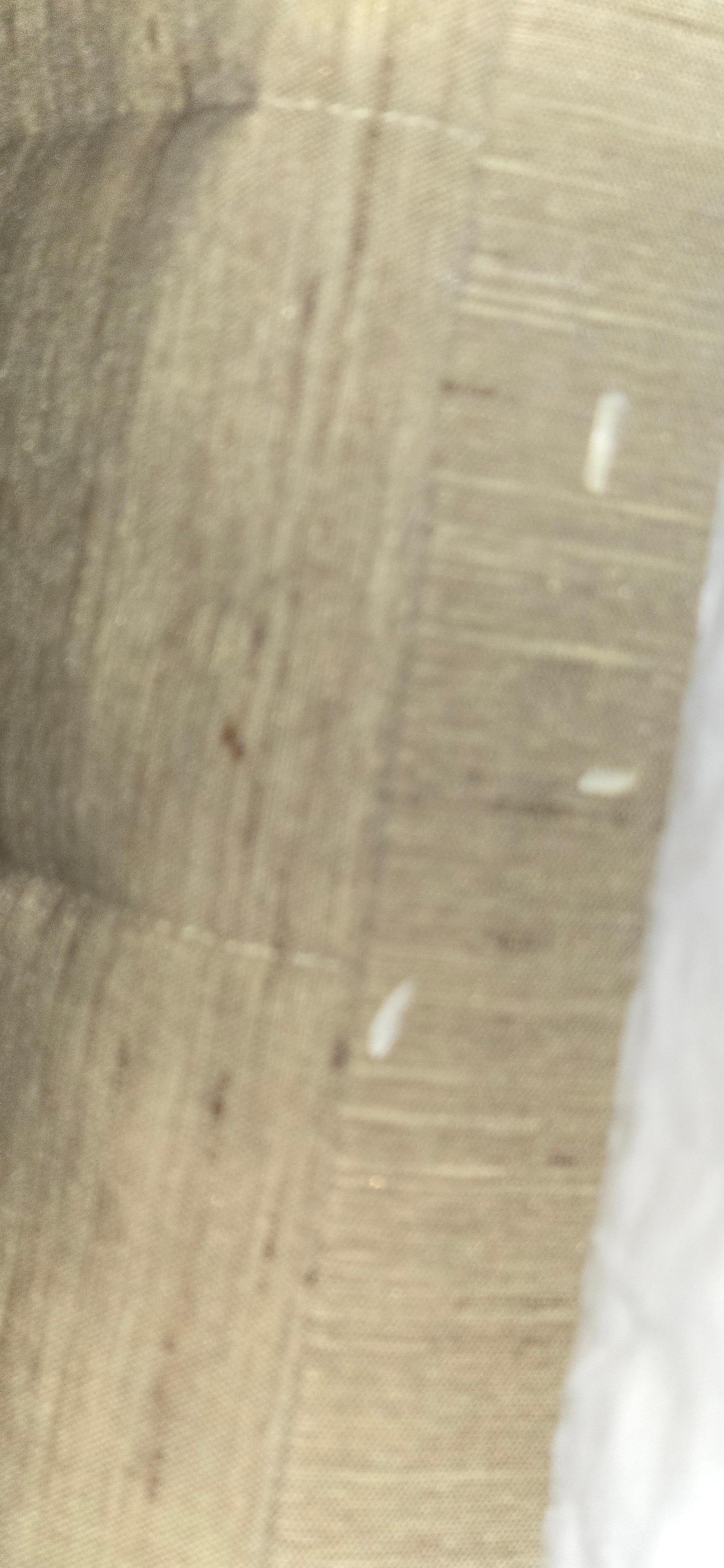 Toe nail clippings on the edge of the bed.