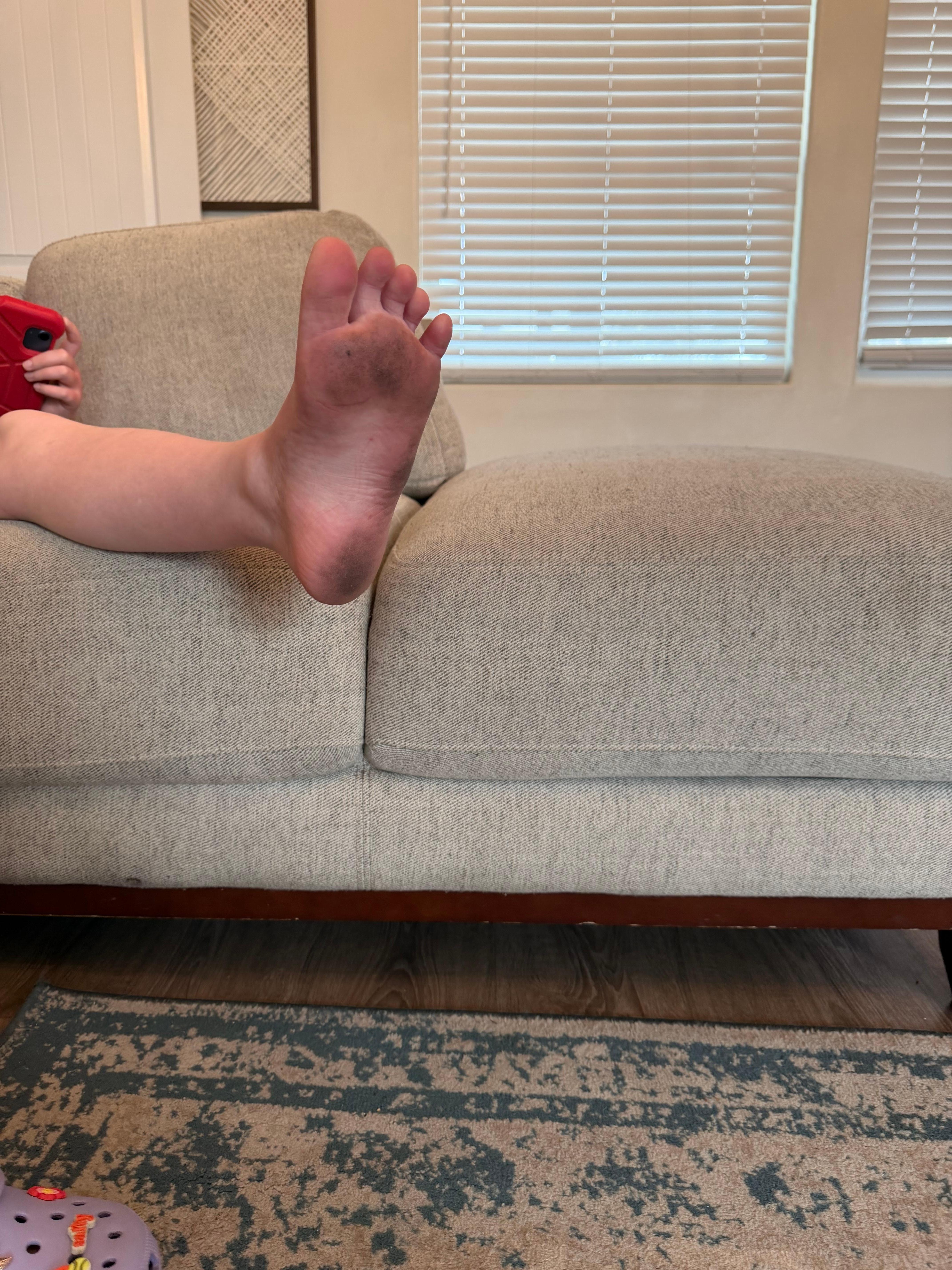 Picture of dirty foot after they came back to clean.