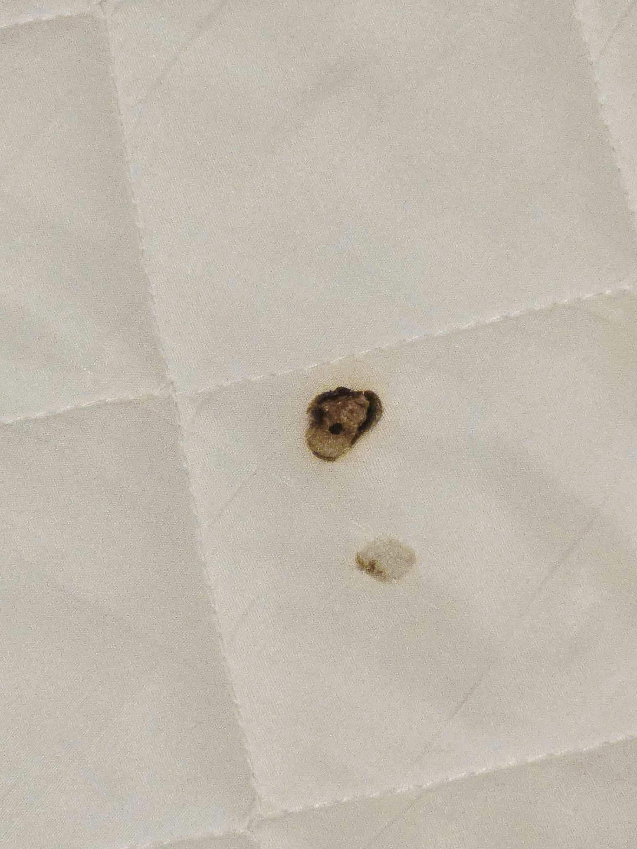 Burn 🔥 mark on bed.