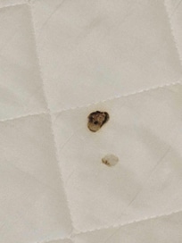 Burn 🔥 mark on bed.