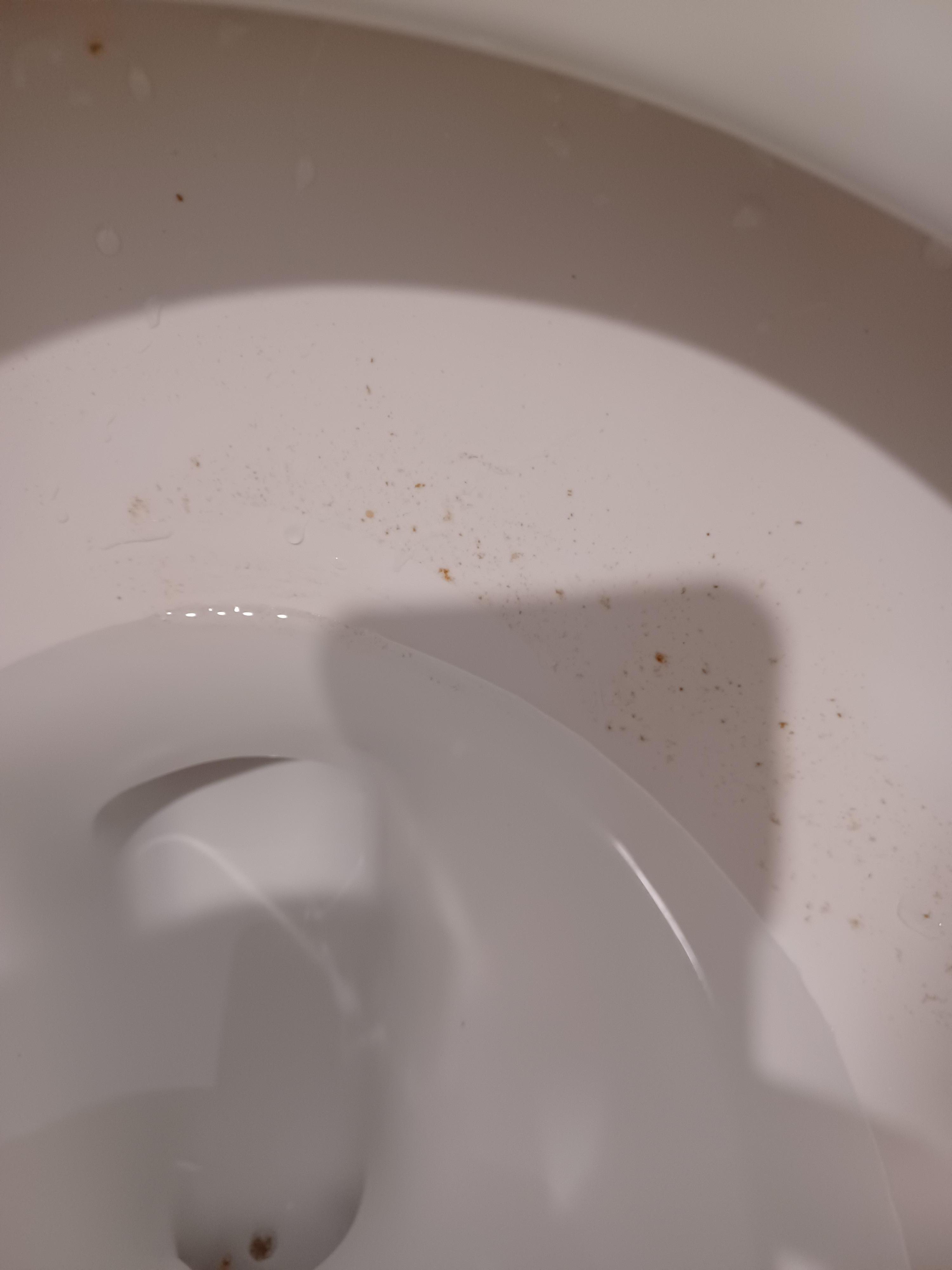 Dirty toilet. 