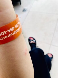 トコジラミ刺され後、宿泊4日