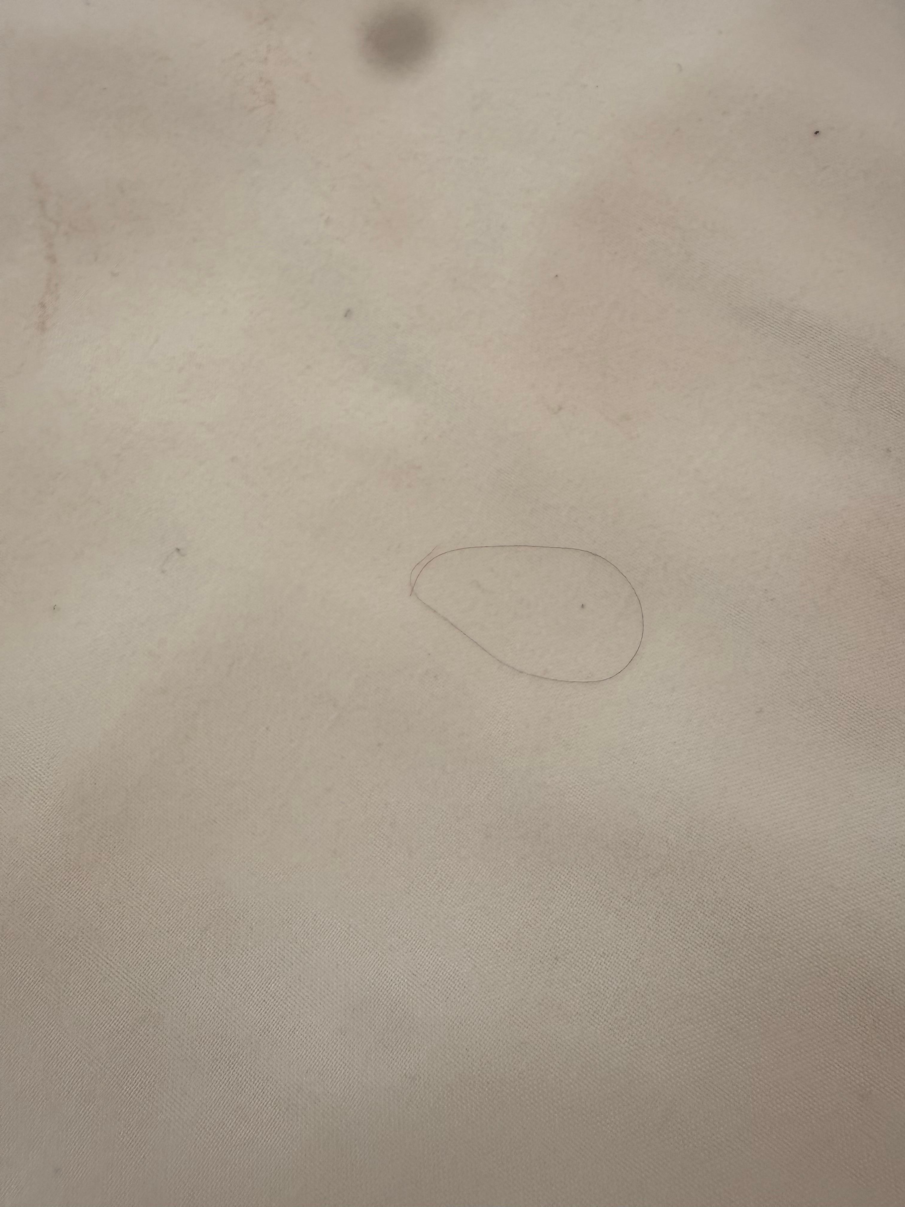 Hairs on the “clean sheets” 