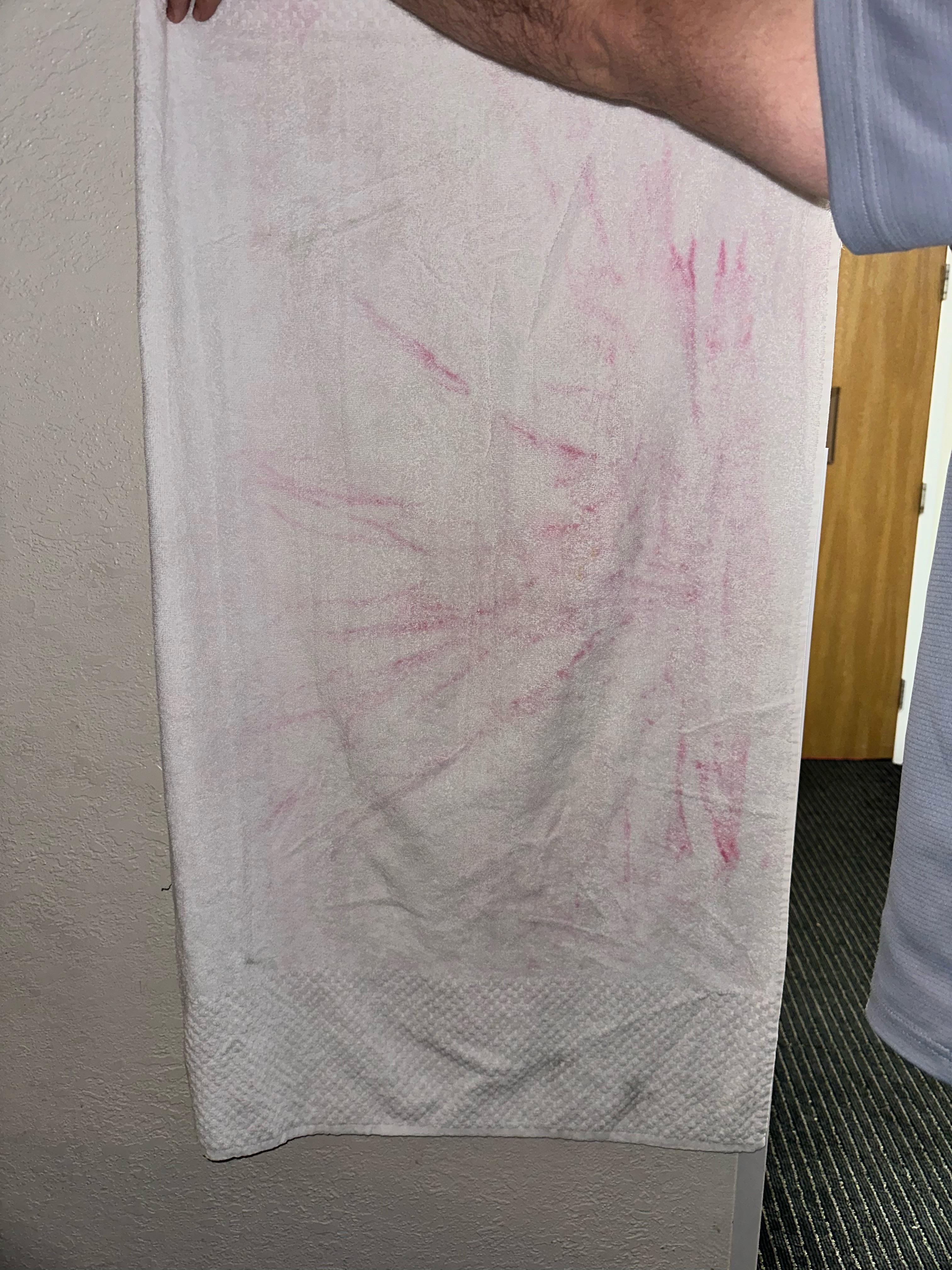 This is the “clean” towel we received 