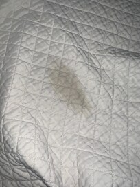 The blankets dirty
