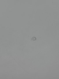Pubic hair