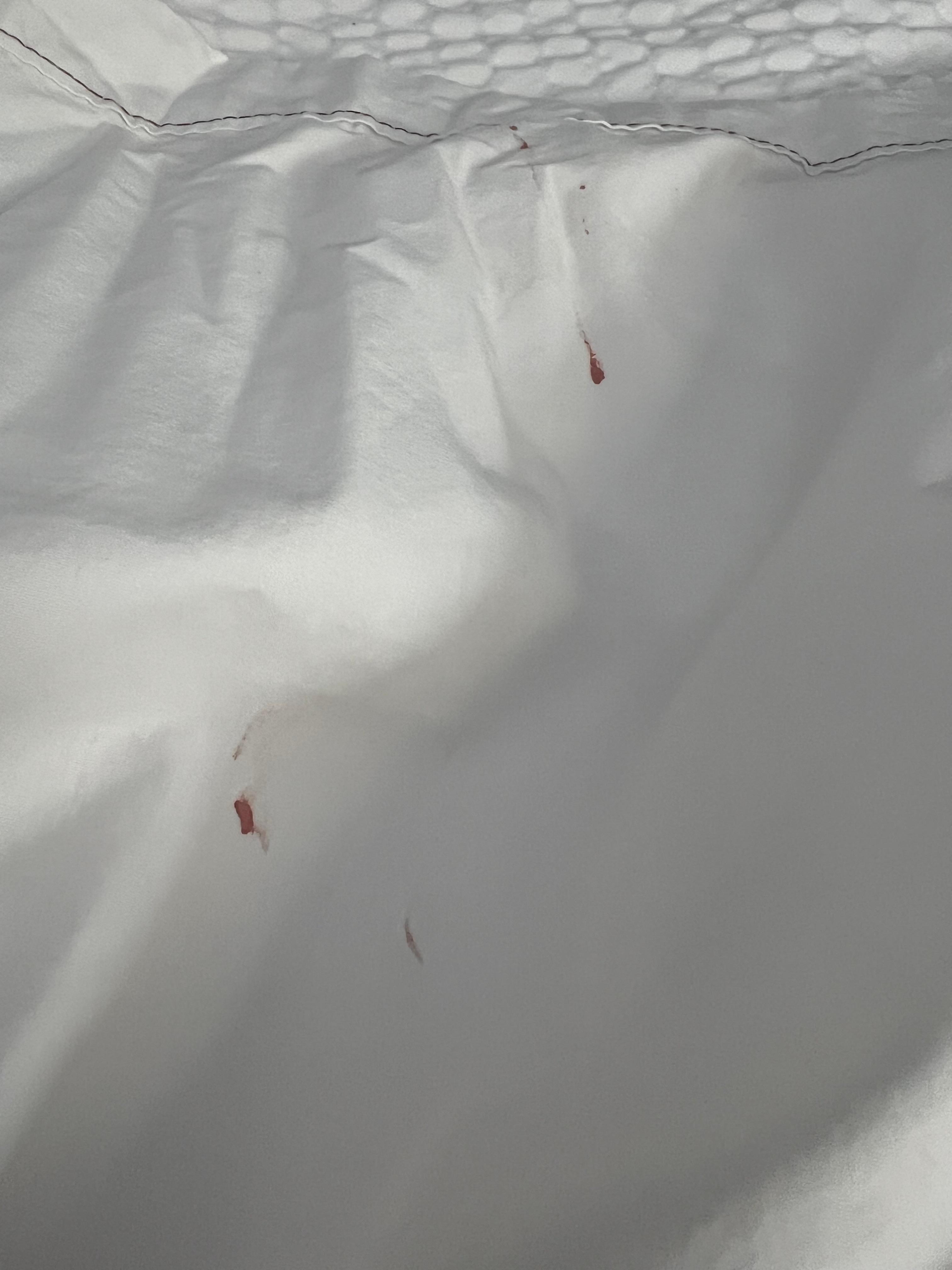 Blood on the top sheet.