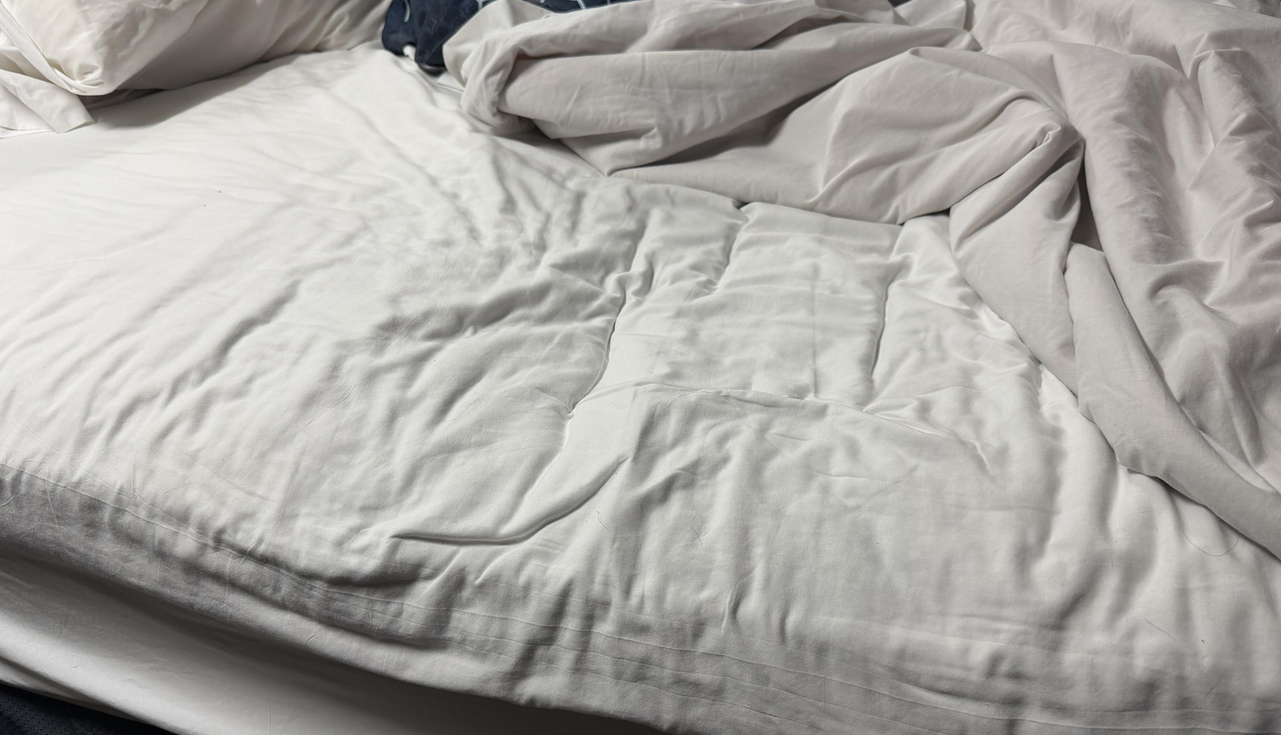 Big Depression Left Side, Lump and hard right side