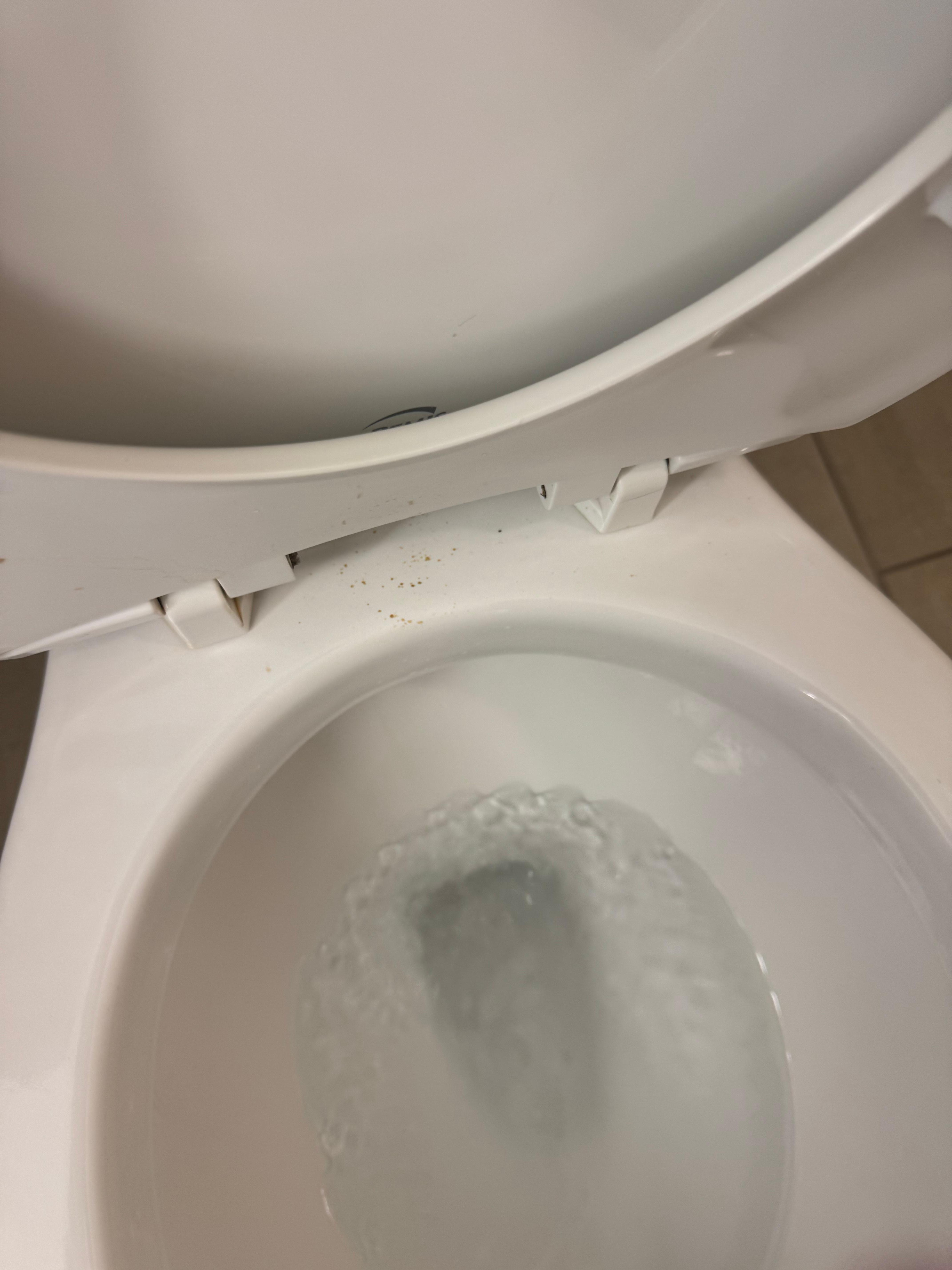 Urine and feces on toilet 