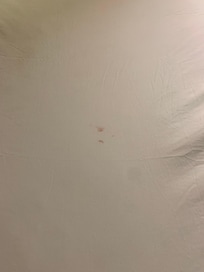 Stain on sheet