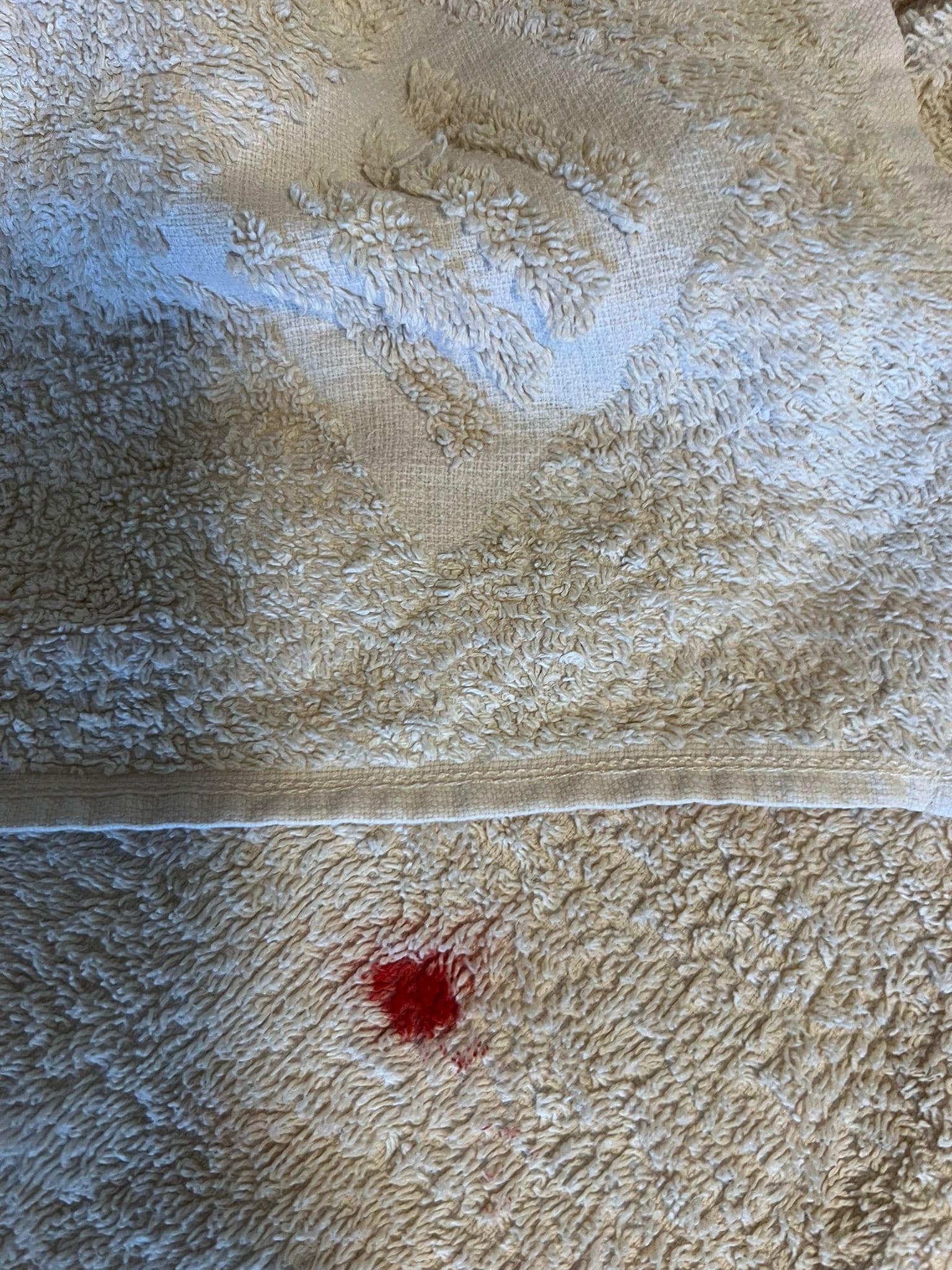 Handtuch mit Blutfleck