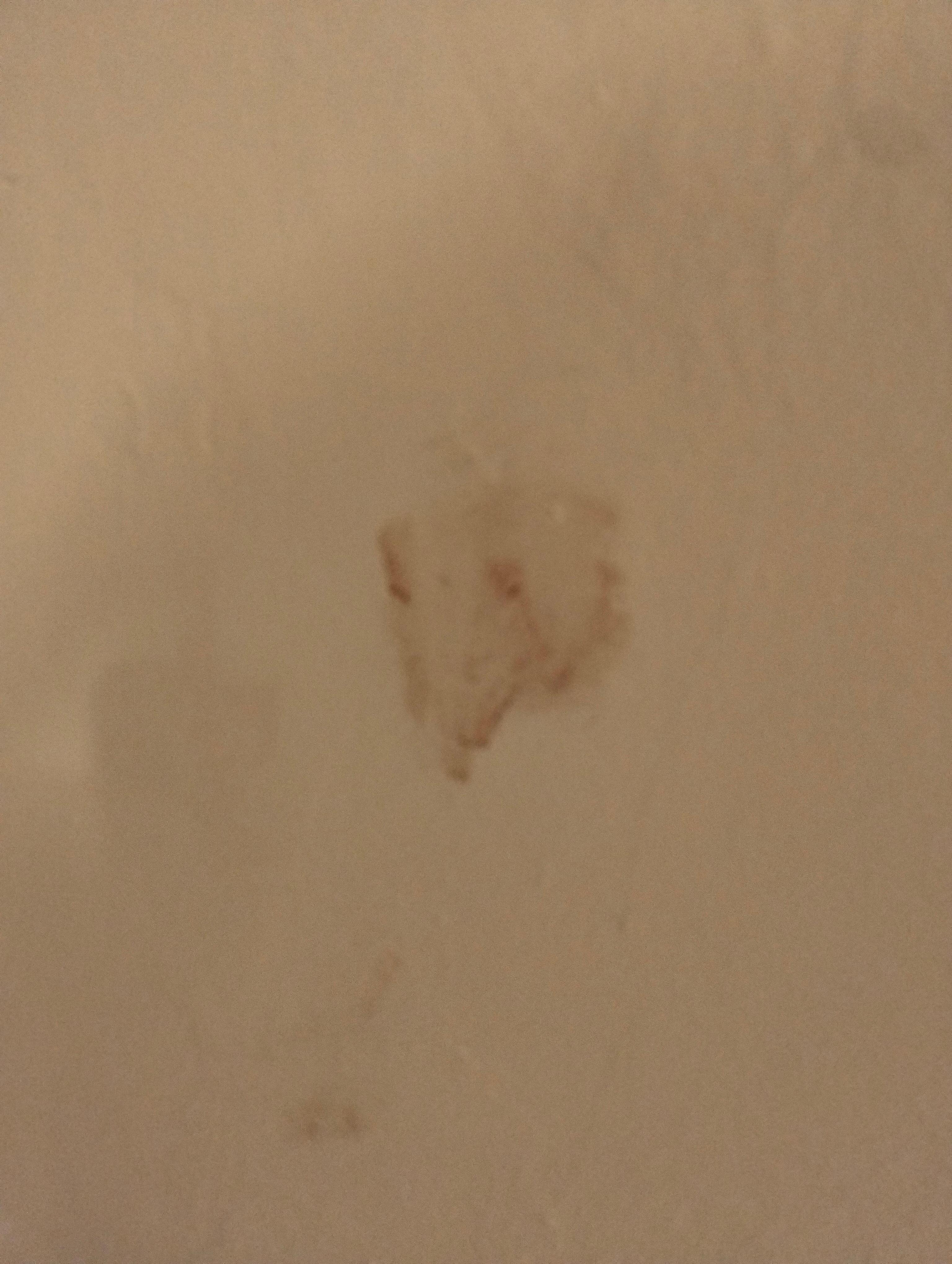 Blood from homeless drug users that stay here 