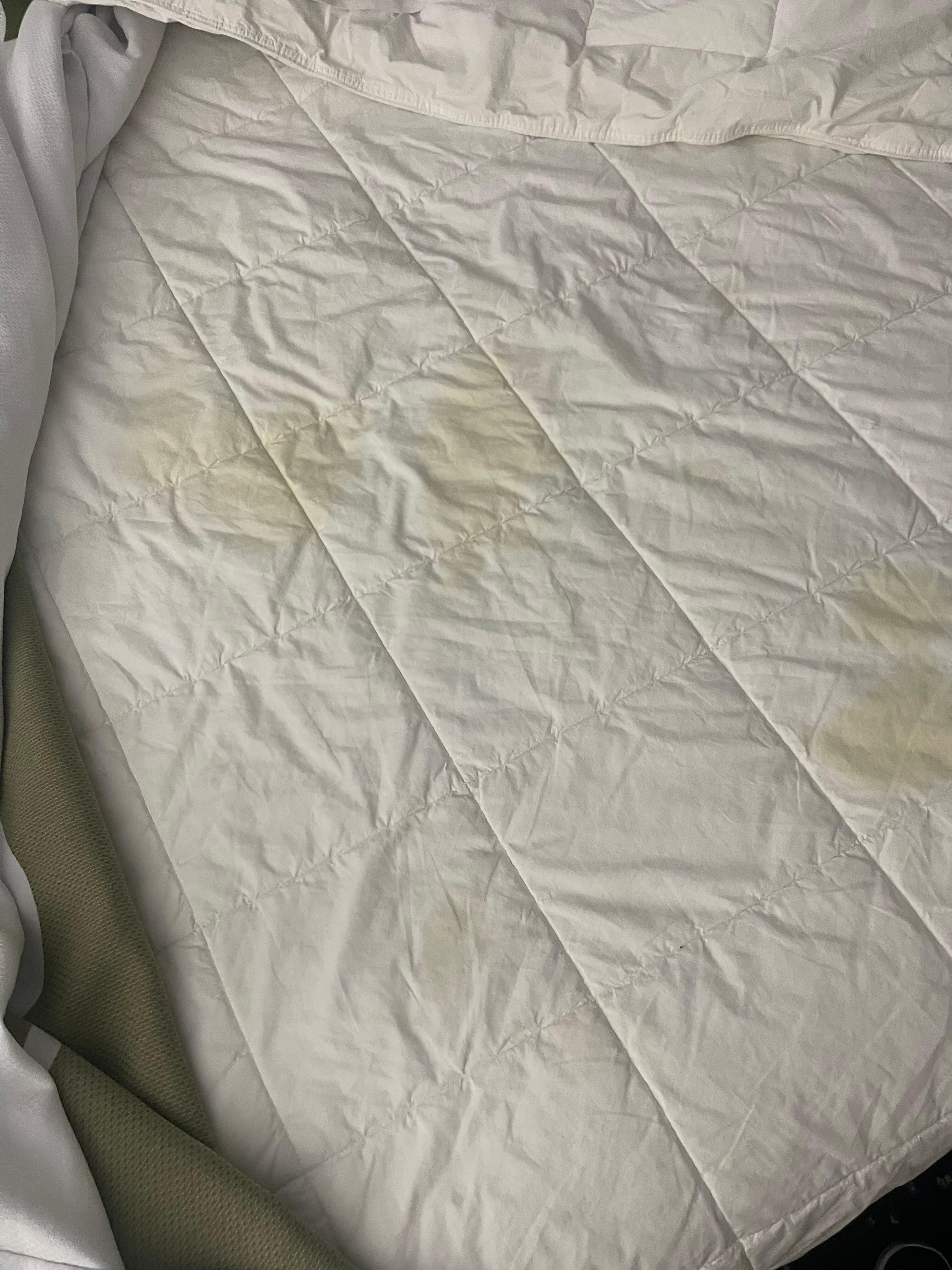 Hard water stains? Are they serious?