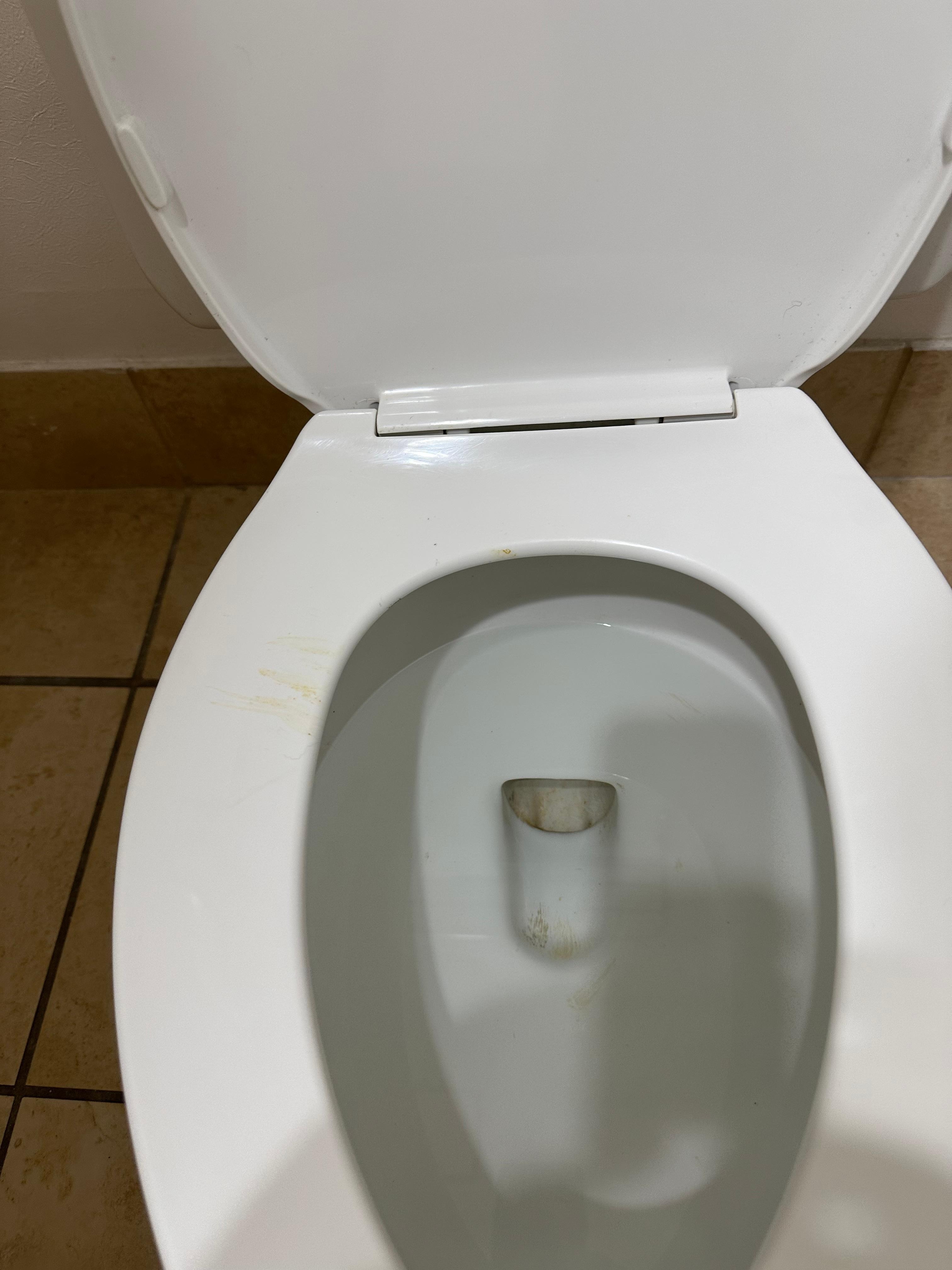 Poop stains on toilet seat