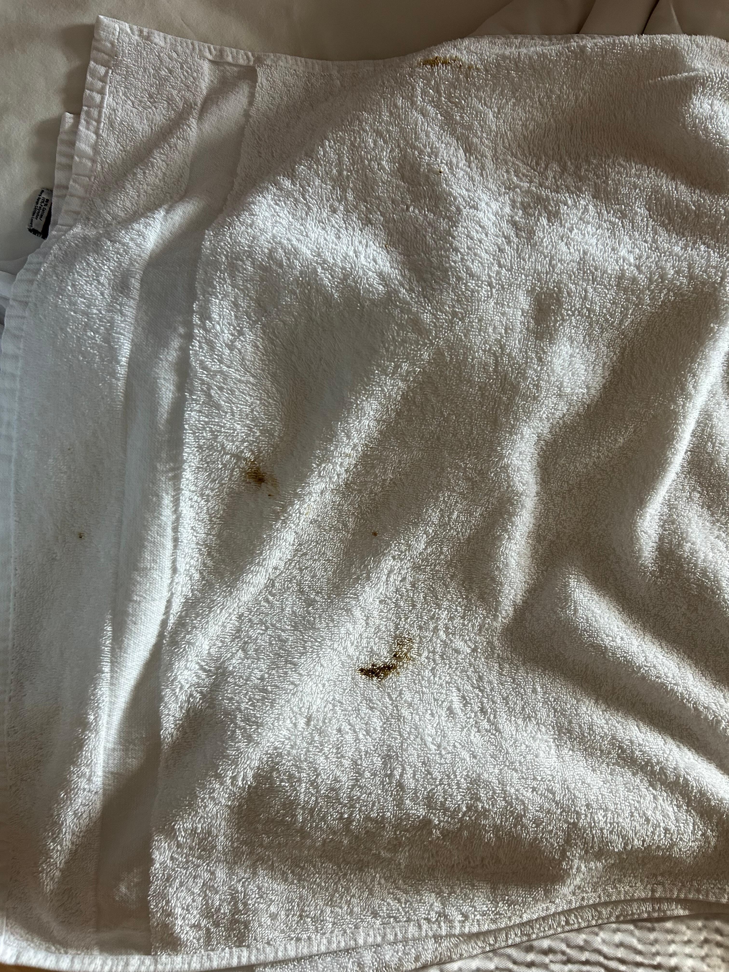 Fecal stain on towel