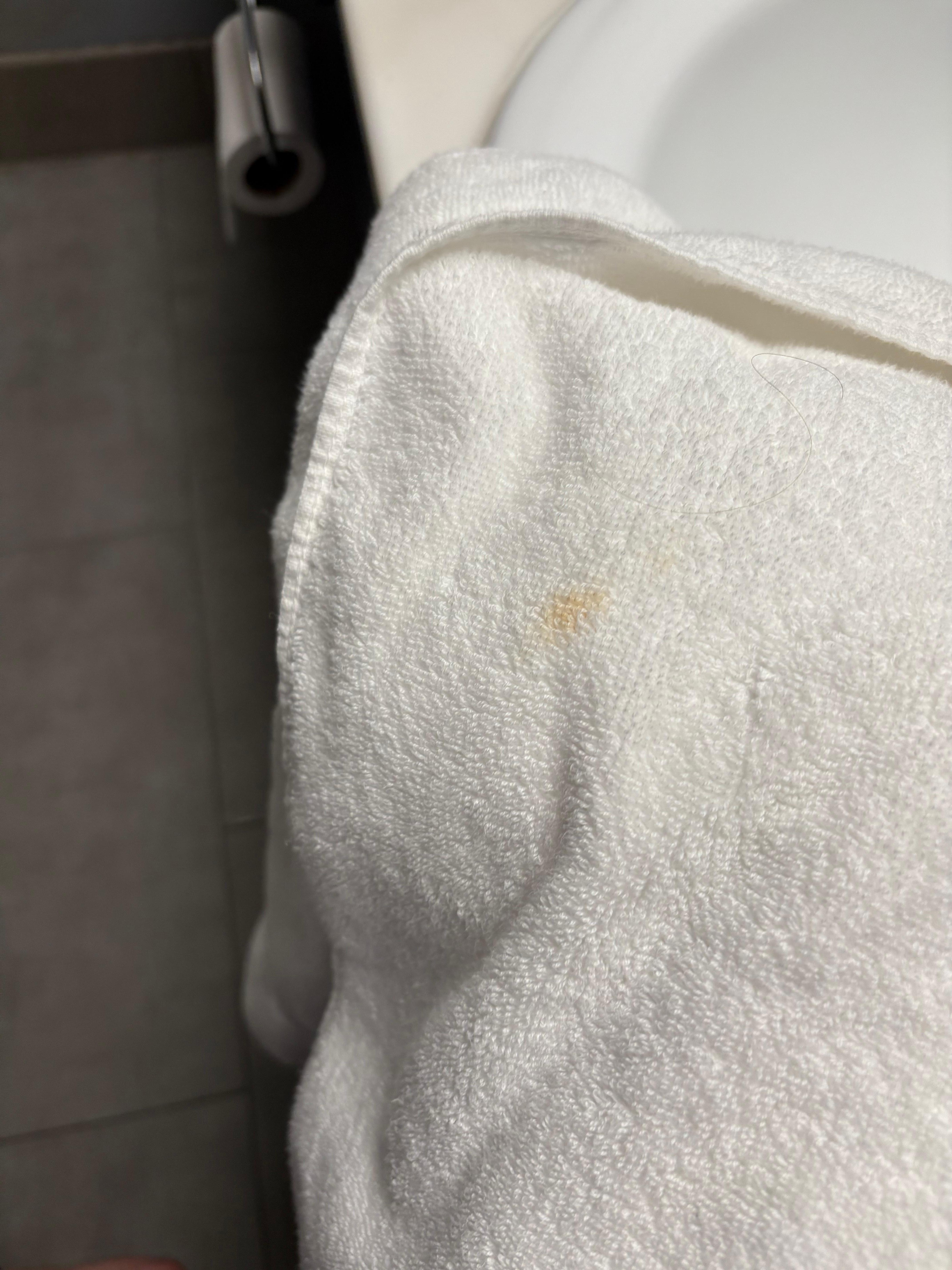 Stained towel plus a unknown hair on the towel
