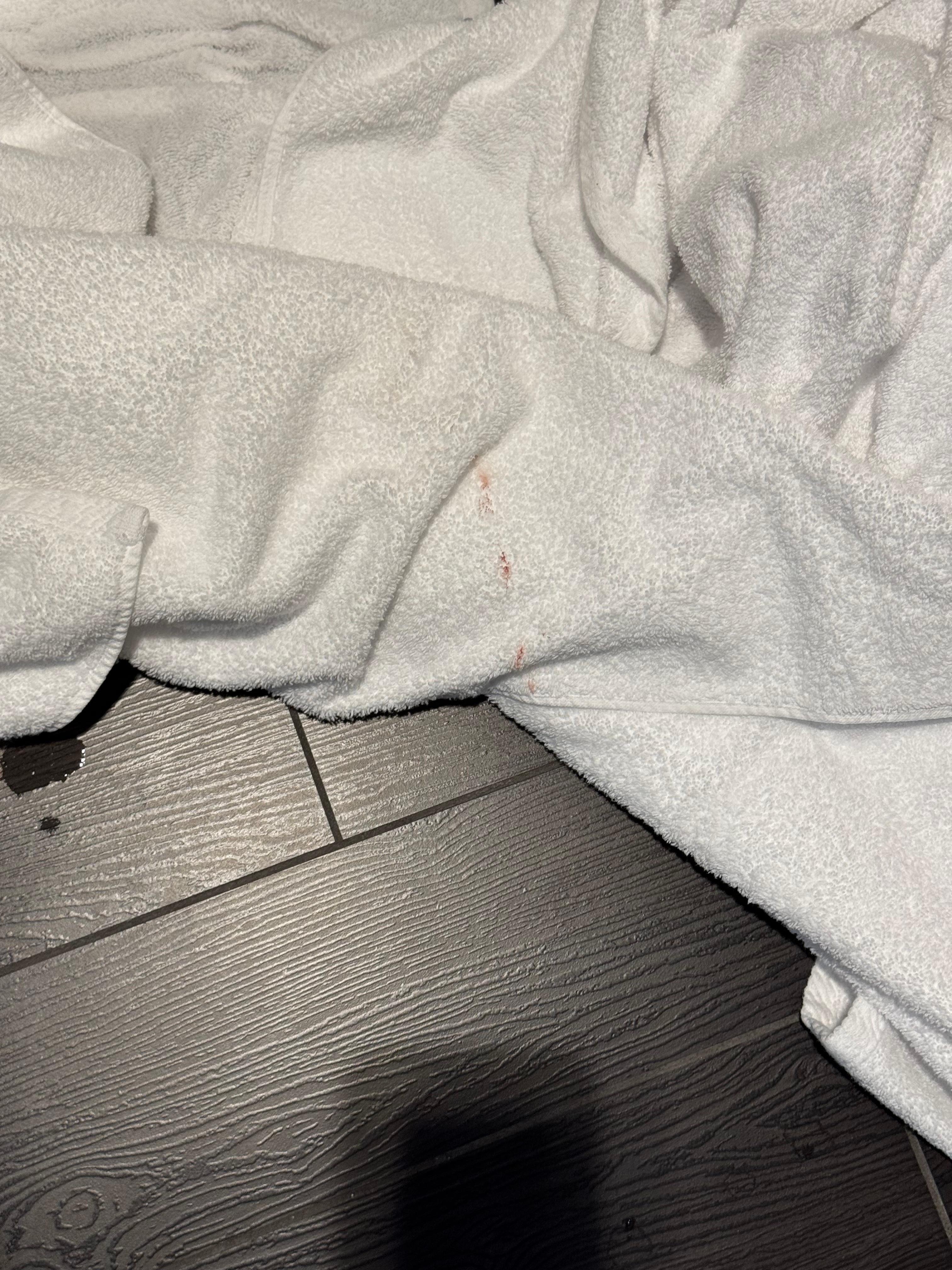 Blood on towel