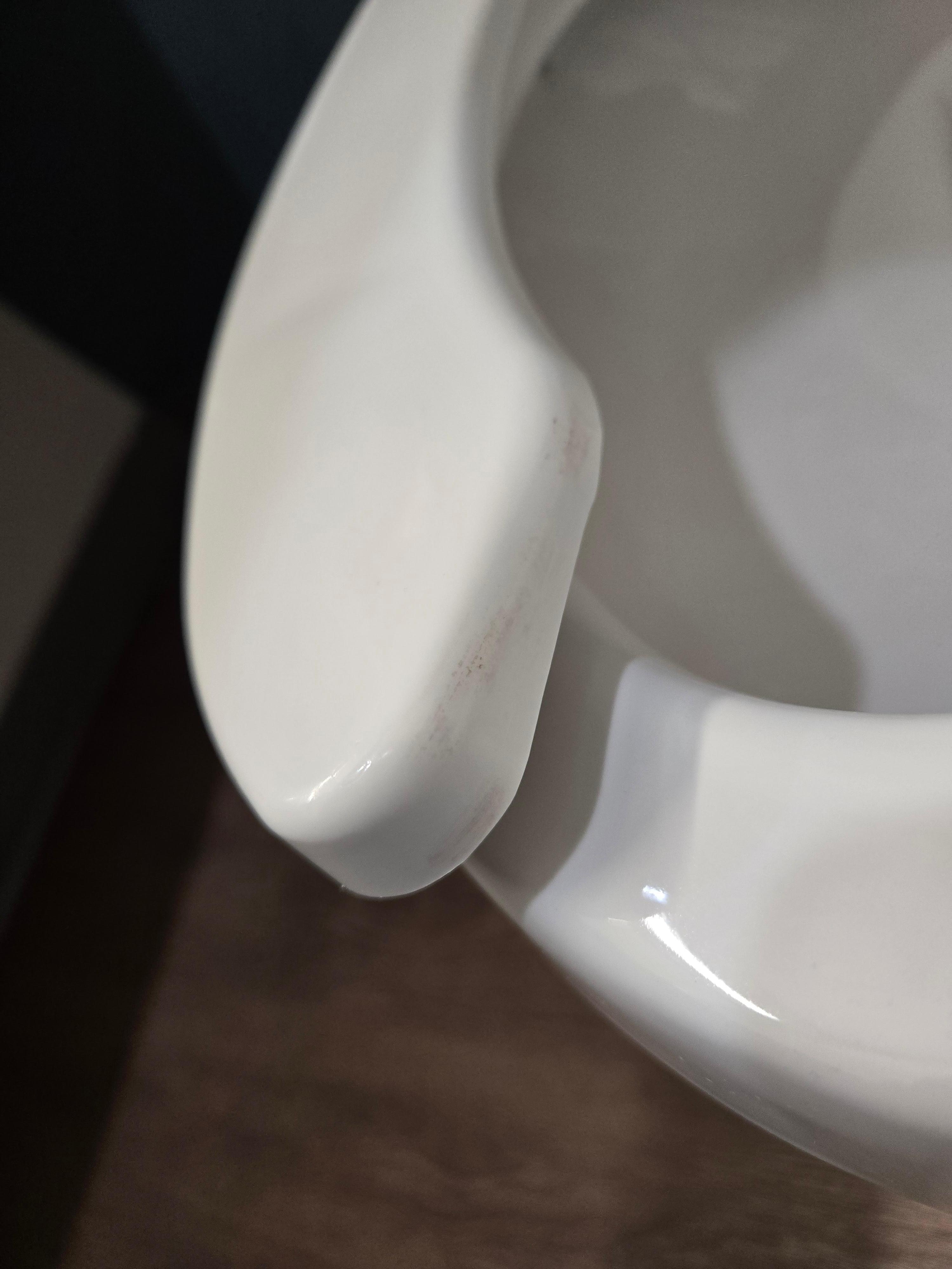 Uncleaned toilet seat