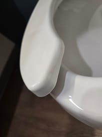 Uncleaned toilet seat