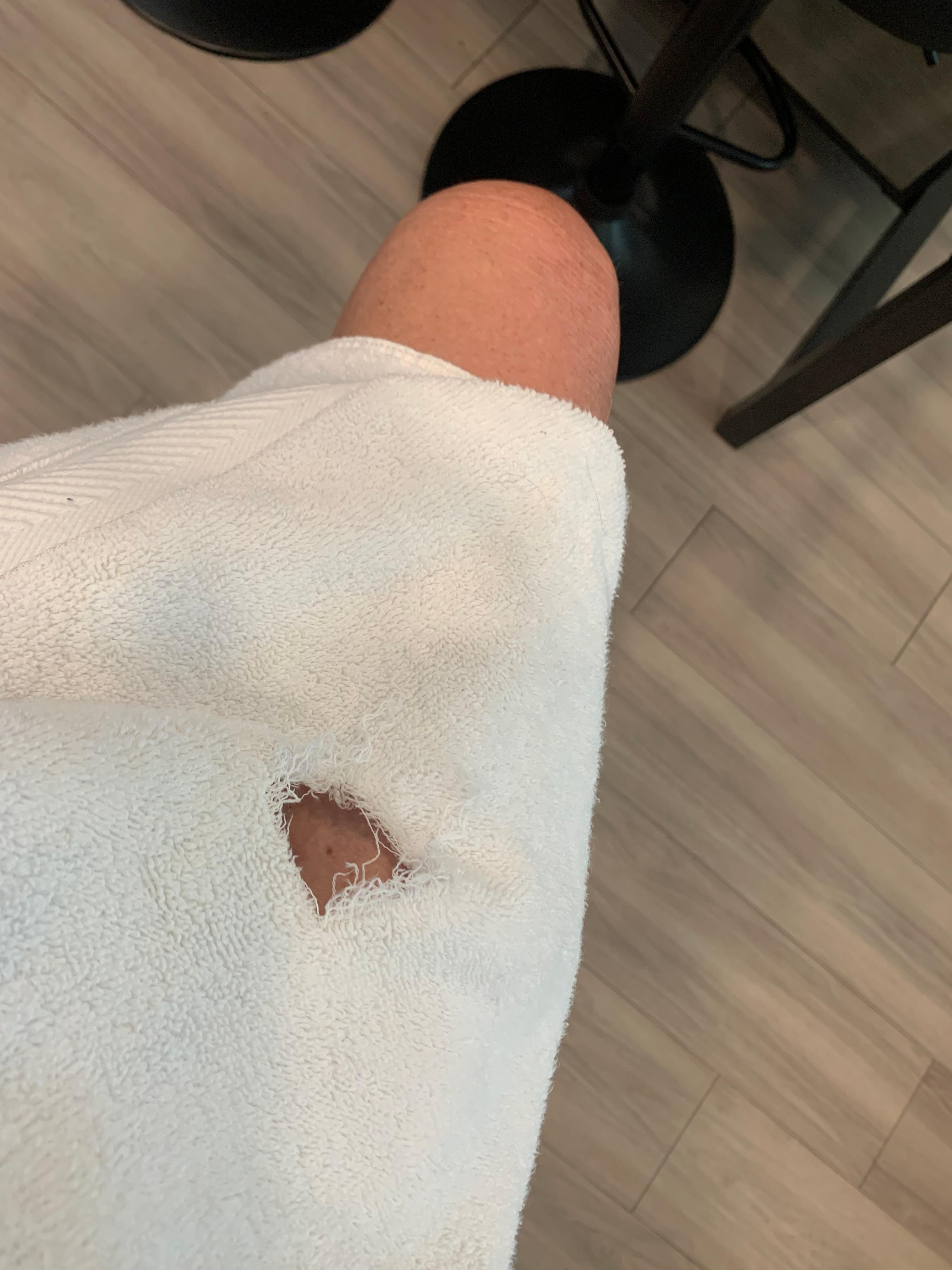 Ripped/torn towel🤷🏼‍♀️