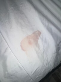 Stained sheets on our bed