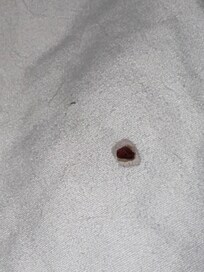 Bloody mucous spot
