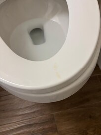 Urine and blood on toilet