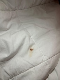 Dried blood stain on blanket