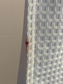 Many blood stains in our shower curtain.