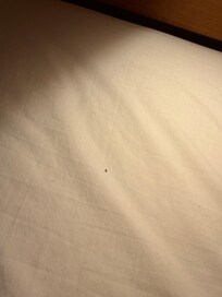 Dried booger and hair