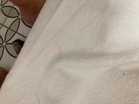 the towels were stained