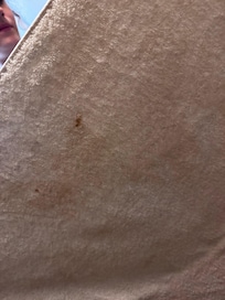Blood on the towels pt. 2