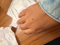 I killed one that was crawling on my hand