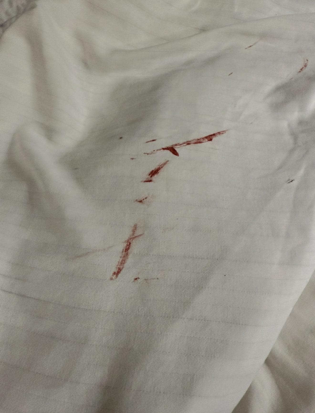 Blood or something on the underside of the bed sheets